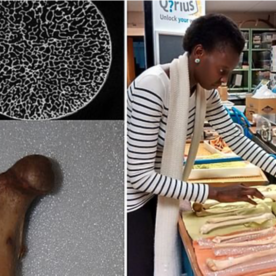 An investigation of bone density and strength in non-human mammals; Habiba Chirchir, PhD., Marshall University; Scientist studying bone density and physical exercise